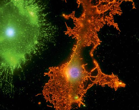 This image shows two important support cells (glial cells) of the human brain. The green splash is a microglial cell, which responds to immune reactions in the central nervous system. <br /><br />Microglial cells recognize areas of damage and inflammation and swallow cellular debris. The larger orange shape is an oligodendrocyte. The ragged extensions of an oligodendrocyte can supply many neurons (nerve cells) with myelin, an insulating material which allows each neuron's communicating axon to transmit electrical impulses efficiently.