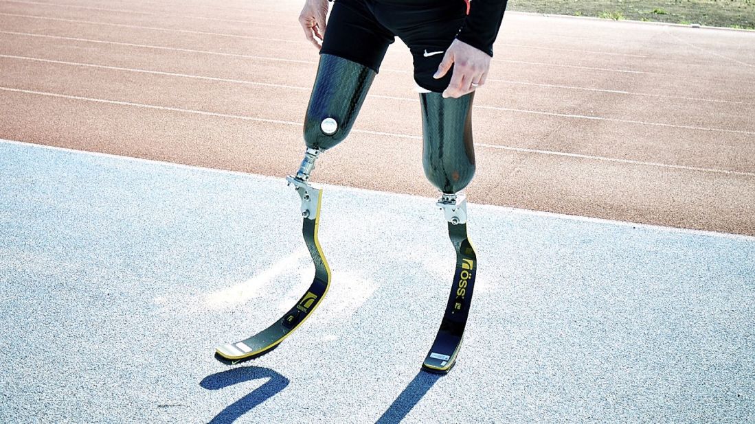 "Prosthetic knee joints are only really good for walking in a straight line on level terrain," says Henson. "Things like riding a bike or walking up and down stairs are really where you start to notice."