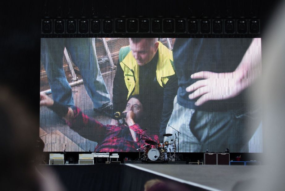 Foo Fighters' Dave Grohl is pictured on a big screen talking into a microphone after falling from the stage and breaking his leg during the band's concert at Nya Ullevi in Gothenburg, Sweden, Friday, June 12. Grohl fell off the stage while performing "Monkey Wrench," the band's second song of the evening. Grohl left the stage and later finished the show from a chair. 