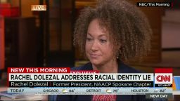 Being black is such a  privilege that some white people, like Rachel Dolezal, a former  NAACP leader, have tried to pass as black, some say. 