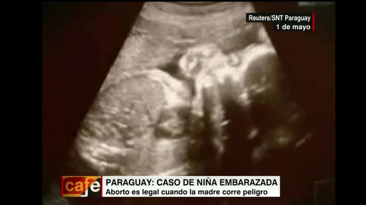 cnnee intvw montero cafe paraguay pregnant girl_00013814.jpg