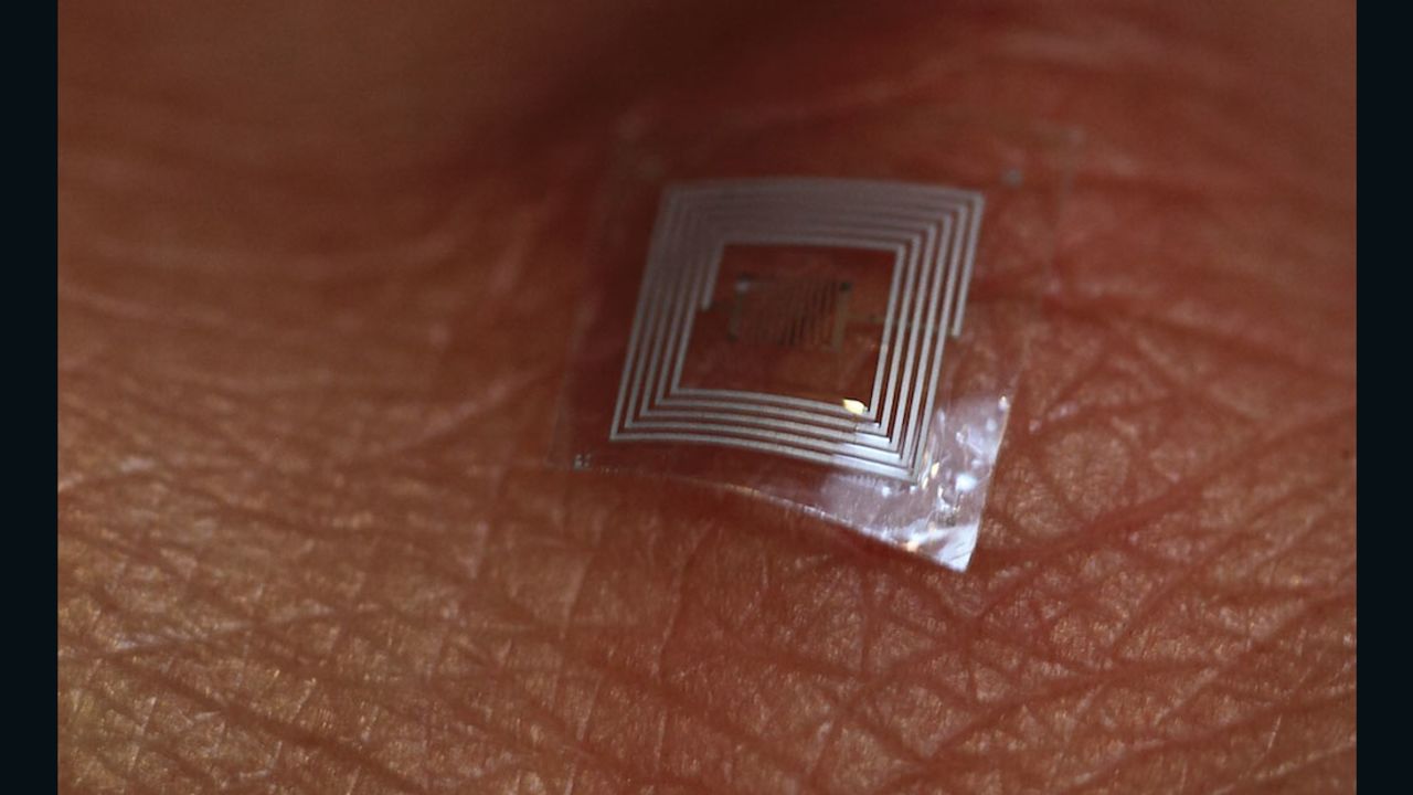 Silk 'microchips,' such as this one, have been implanted in lab mice to help heal sores.