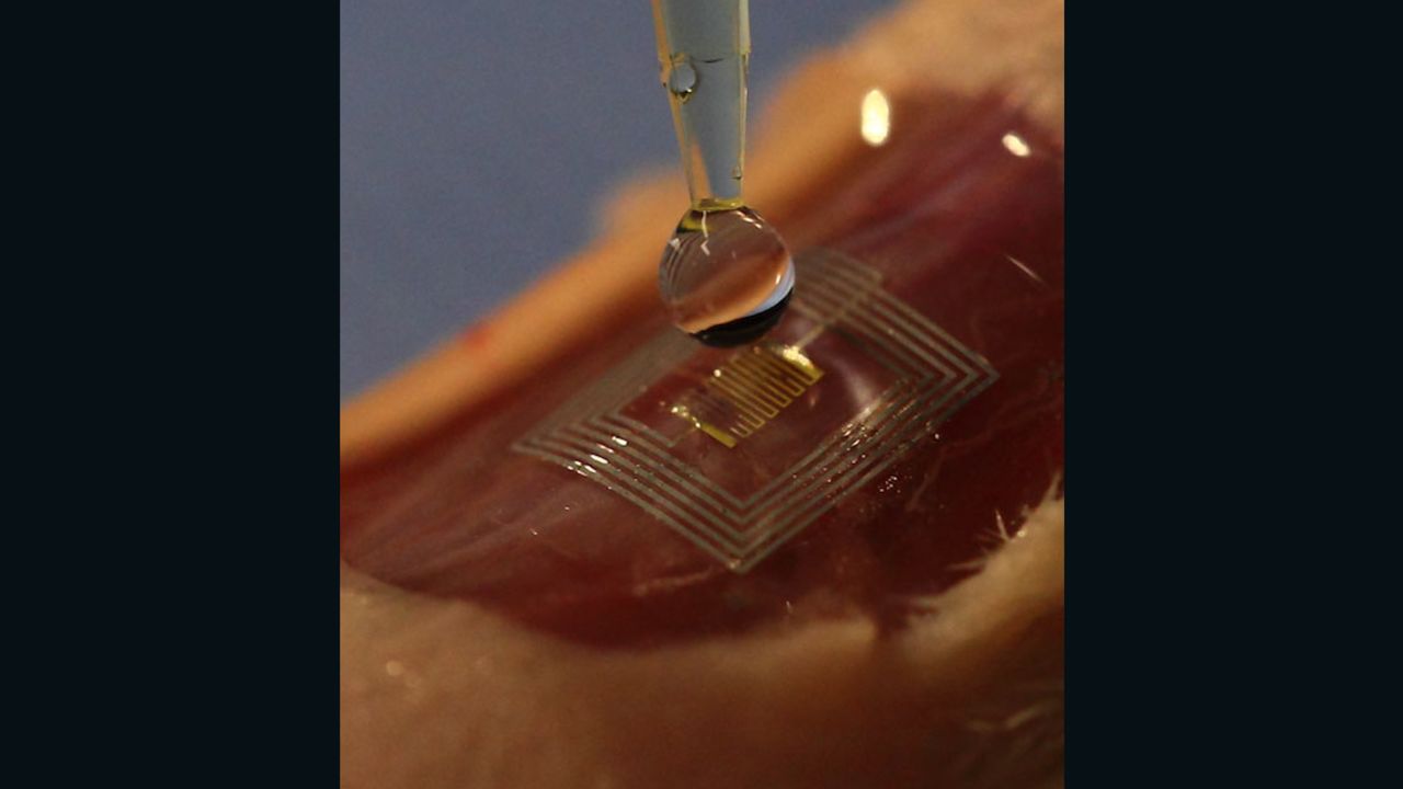 This healing silk 'microchip' could be implanted under the skin.