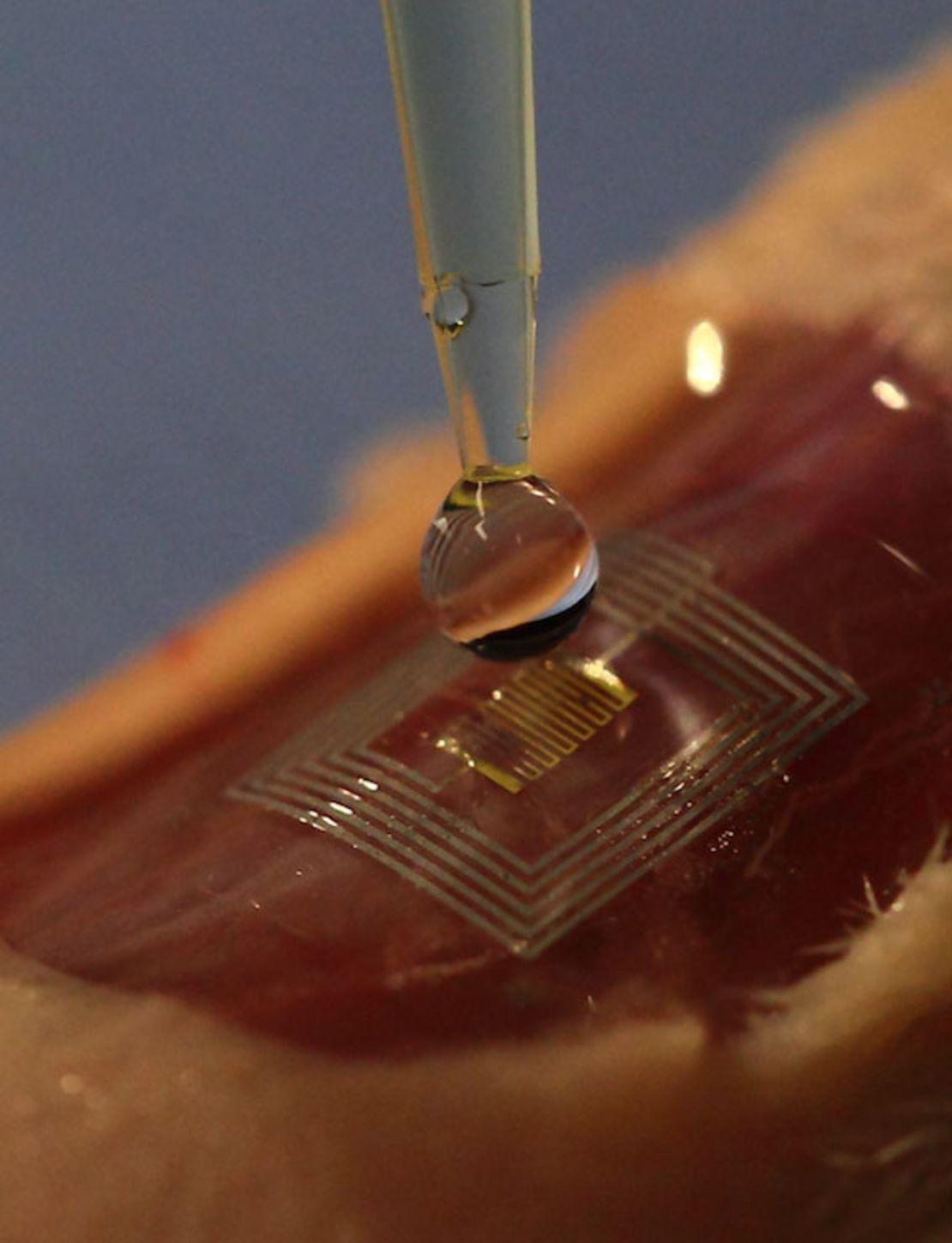 This healing silk 'microchip' could be implanted under the skin.