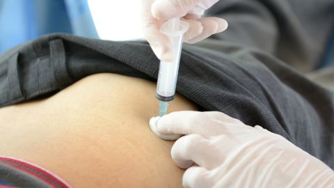 Illegal buttocks injections can result in infection, scarring and even death 