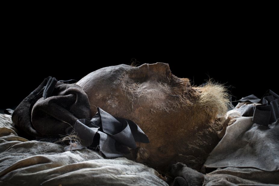 Bishop Winstrup's remains are unusually well preserved, researchers say, constituting "a unique archive of medical history on the living conditions and health of people living in the 1600s."