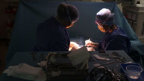 Head transplant surgery is highly controversial and its feasibility has been questioned by experts.
