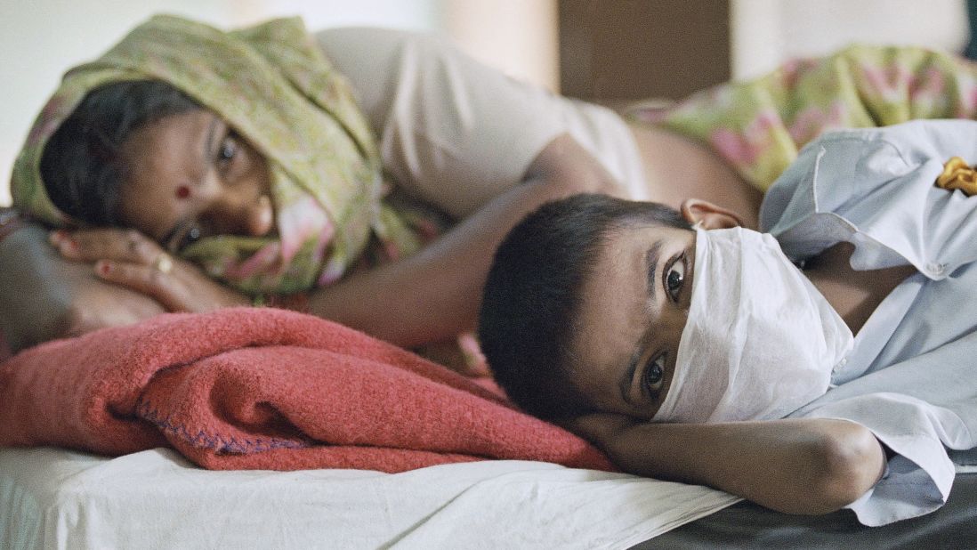 A patient with plague symptoms, foreground, awaits test results with his mother at New Delhi's Disease Hospital in 1994. Pneumonic plague, which infects the lungs, is the most serious form of the disease and the only way it can spread directly between people. A plague outbreak in India in 1994 was among the most serious in the world in recent decades.