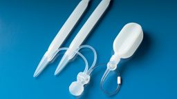 This 3-piece inflatable implant can help men with ED achieve an erection after surgical installation. When the smaller bulb is squeezed, saline solution is pumped from the larger reservoir into the two columns on the left, causing them to inflate.