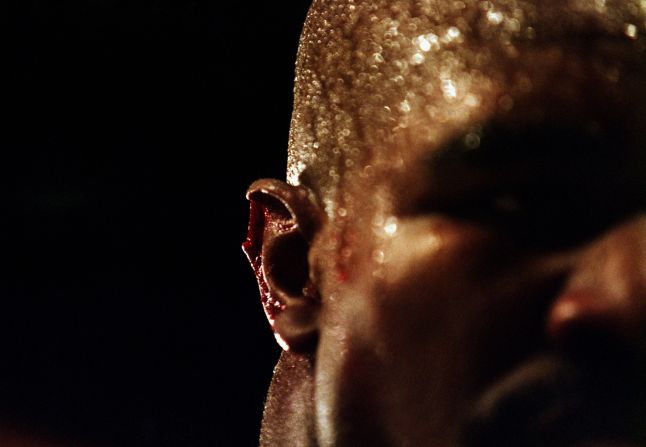 MIke Tyson took up residence in sport's "Hall of Shame" after biting a section out of Evander Holyfield's ear during their world heavyweight title fight in 1997. Tyson was disqualified by the referee and lost his boxing license, although it was later returned to him.