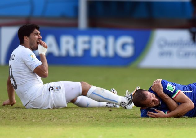 Luis Suarez clutches his teeth moments after biting Italy defender Giorgio Chiellini during their 2014 World Cup clash. The Uruguayan is still serving the nine-match international ban he received for his actions. 