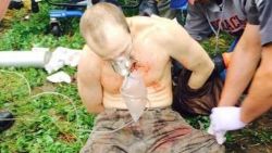 This photos, obtained by CNN, was taken of escaped Clinton Correctional Facility inmate David Sweat shortly after capture on Sunday, June 28, 2015. In the photo, Sweat is bloodied, shirtless, cuffed at the ankles, and appears to be breathing into an oxygen mask.