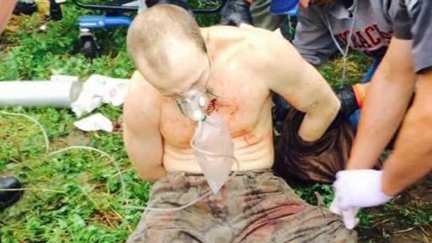 This photos, obtained by CNN, was taken of escaped Clinton Correctional Facility inmate David Sweat shortly after capture on Sunday, June 28, 2015. In the photo, Sweat is bloodied, shirtless, cuffed at the ankles, and appears to be breathing into an oxygen mask.