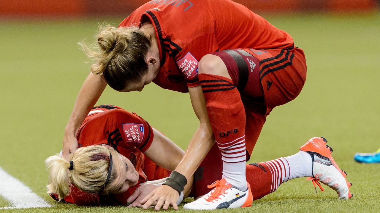 Germany's Alexandra Popp, left, clashed heads with American Morgan Brian early in the match. Both players received treatment and returned to action.