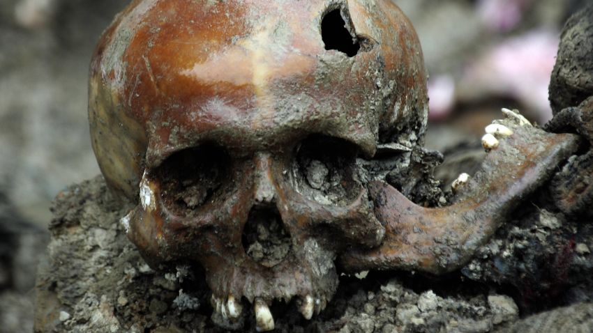 A broken skull lays exhumed in a newly discovered mass grave site in the village of Budak, just a few hundreds meters away from the Memorial Center of Potocari, near the eastern Bosnian town of Srebrenica, 11 July 2007.