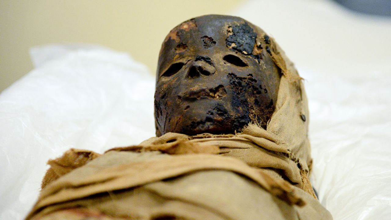 An ancient Egyptian child mummy is prepared for a computer tomographic scan in Hildesheim, Germany.