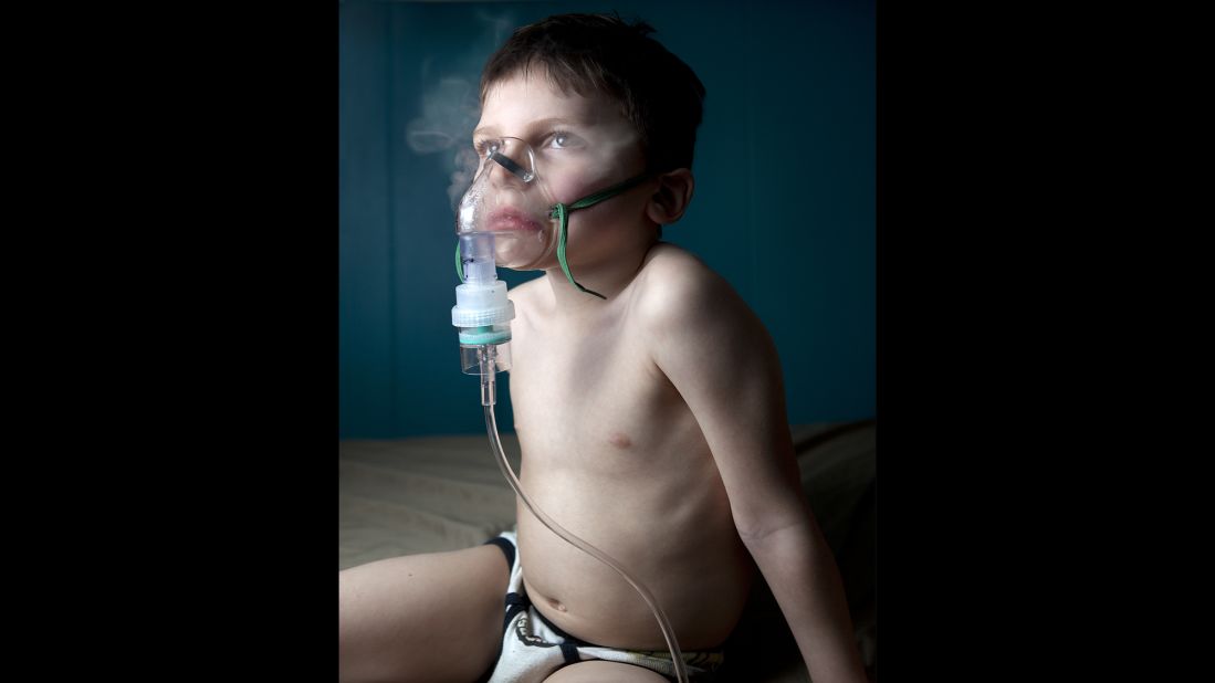 Thomas uses his nebulizer to treat a dry cough, which he develops seasonally, De Alba said.