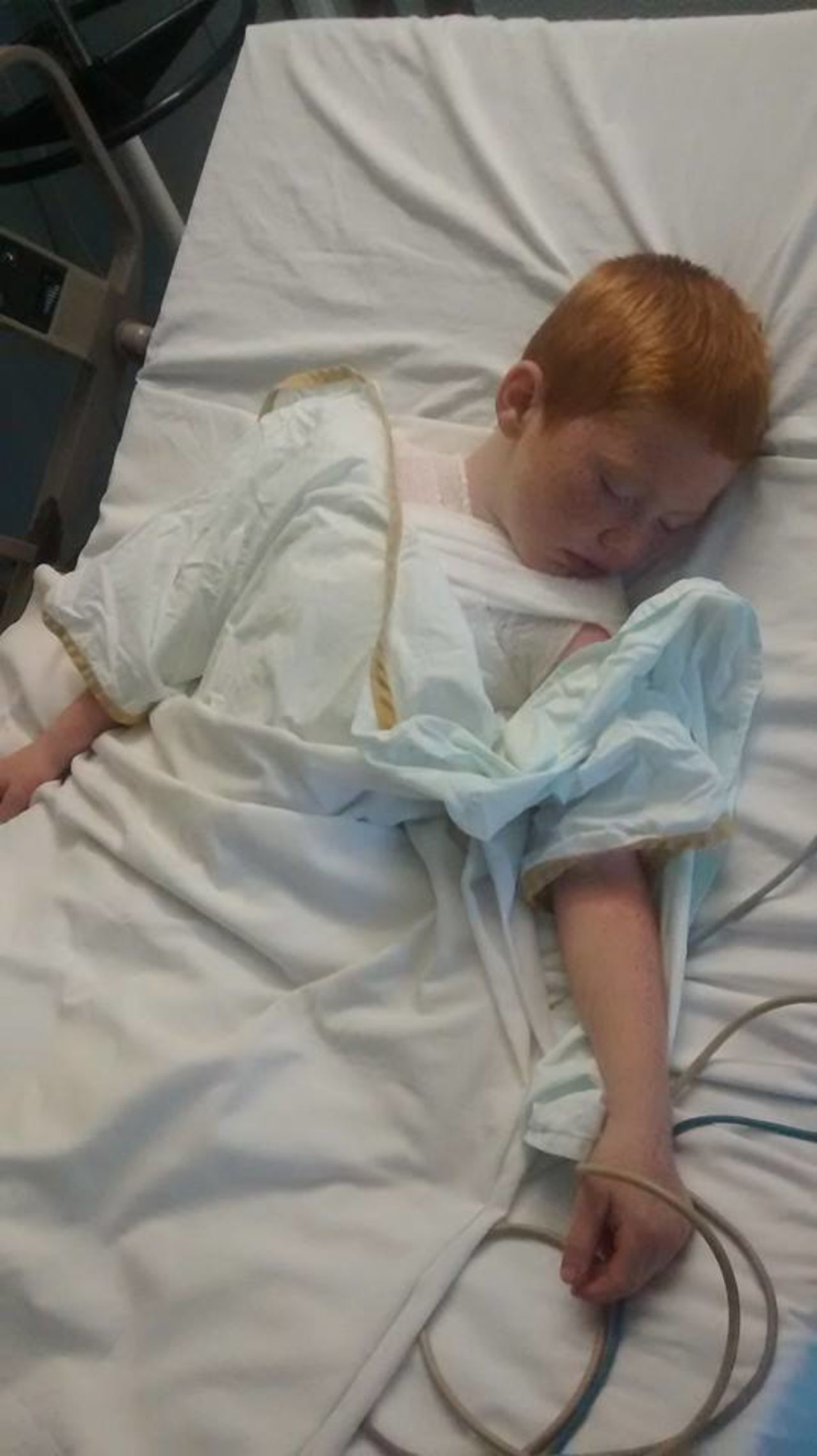 Connor and Trae Broadway remain at Shriners Hospital for Children in Dallas after suffering severe burns at a water park Friday. Connor, age 7, suffered the worst of the burns.