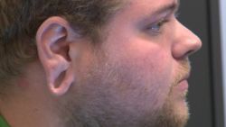 stretched earlobe regret cosmetic surgery pkg_00000904.jpg