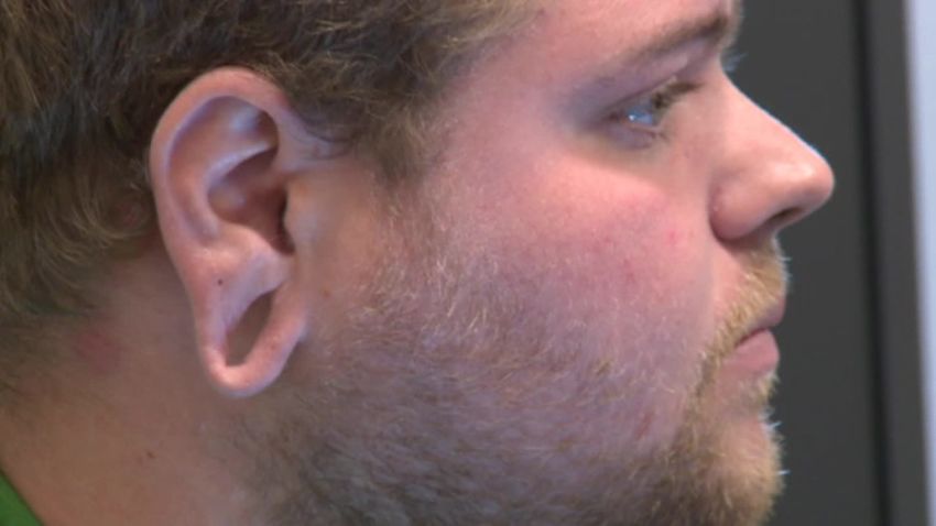stretched earlobe regret cosmetic surgery pkg_00000904.jpg