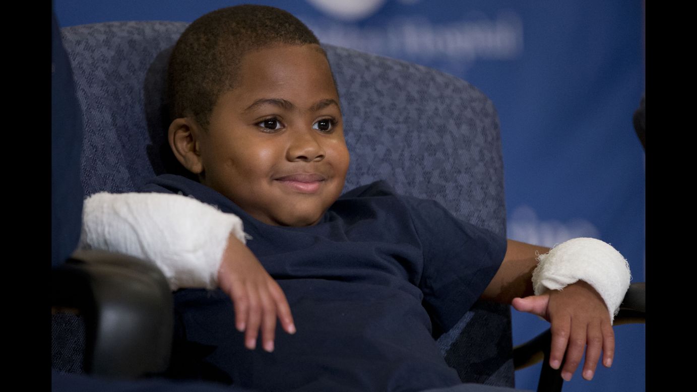 Zion Harvey, an 8-year-old boy <a href="http://www.cnn.com/2015/07/29/us/baltimore-boy-zion-harvey-first-double-hand-transplant-recipients/" target="_blank">who received a double hand transplant,</a> smiles during a news conference Tuesday, July 28, in Philadelphia. The 10-hour surgery required 12 surgeons and was the first of its kind to be performed on a child.
