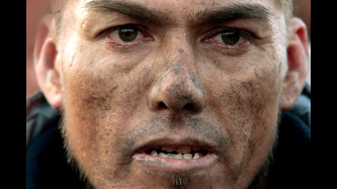 Miner Daniel Espinoza waits outside the collapsed copper and gold mine to help in the rescue efforts on August 7.