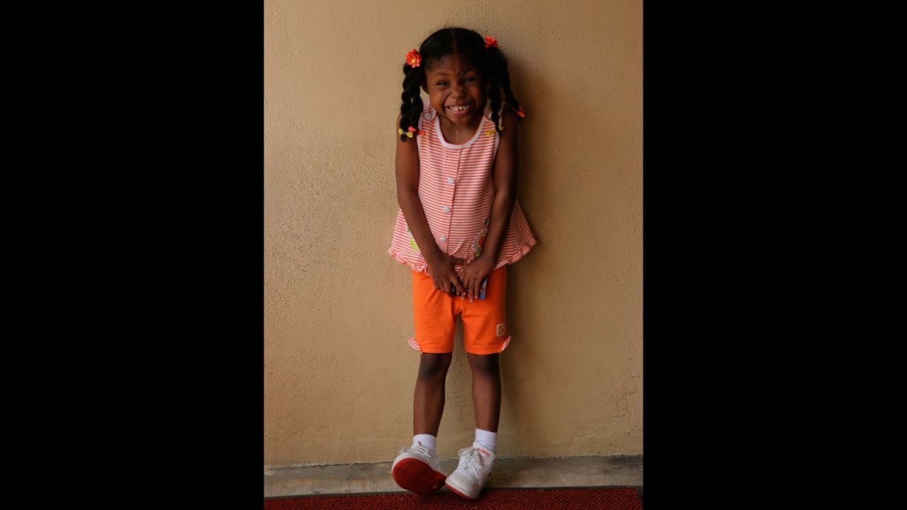 Jayda, living with a deletion missing from her 22nd pair of chromosomes, loves to sing and dance. 