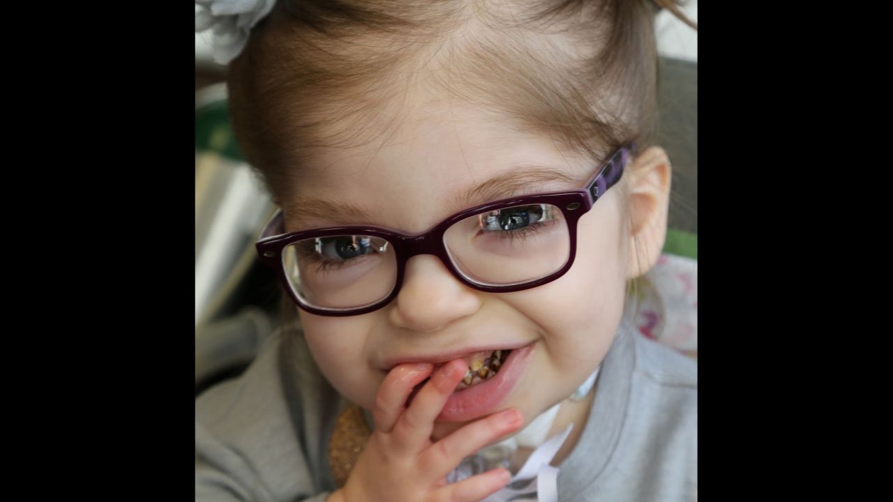 Campbell was diagnosed with multiple congenital heart defects and agenisis of the corpus collusom. She just turned 5 and loves the soundtrack to "Frozen," reading books and playing with dolls and ponies. She has recently started using a few signs to communicate but has discovered that signing "please" using a sad face usually gets her whatever she wants.