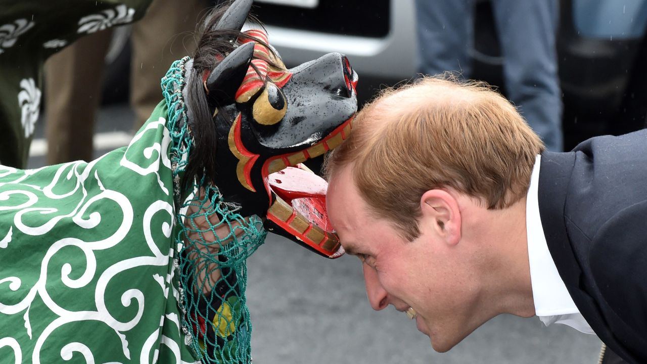Balding can make men look wise and established, like Prince William, although most would probably prefer the youthful appearance of a full head of hair. 