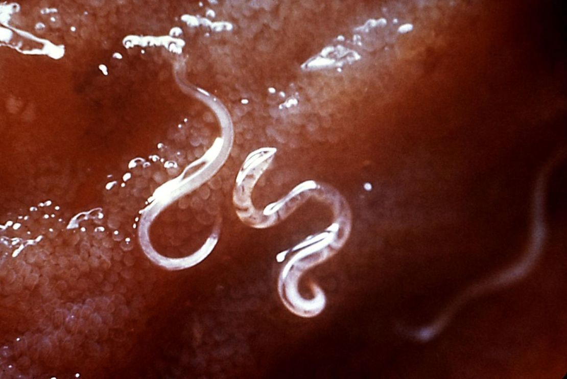 A type of hookworm, attached to the intestinal mucosa.