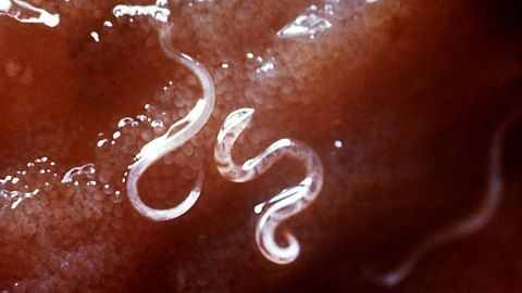 A type of hookworm, attached to the intestinal mucosa.