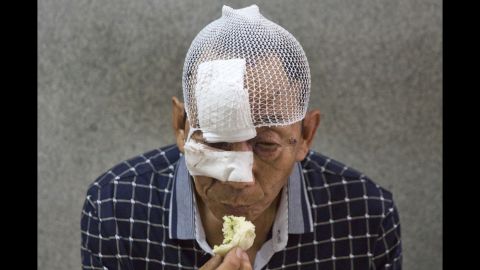 A bandaged man eats in a hospital in Tianjin.