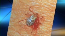 Certain ticks can carry RMSF