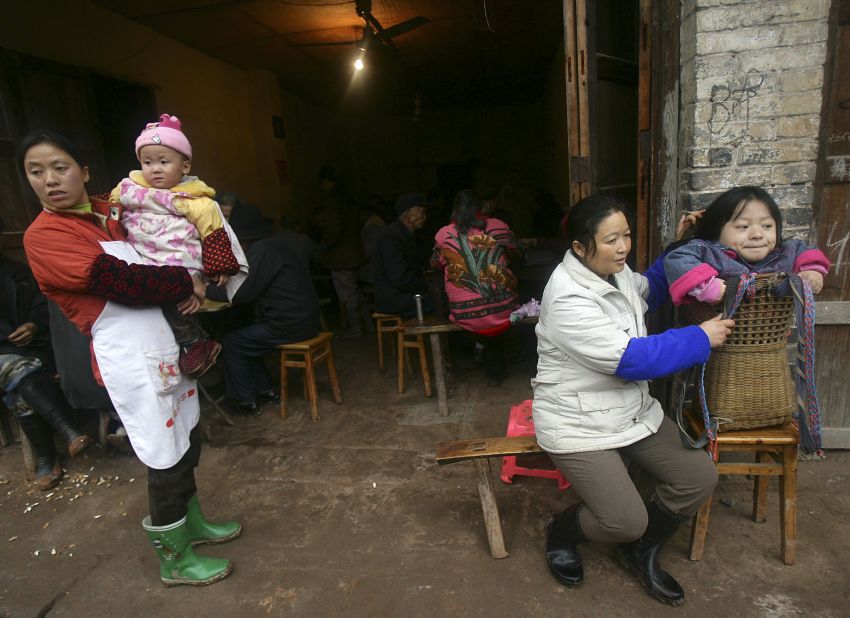 This 19-year-old girl in Neijiang, China, is being carried in a basket because she has rickets. Rickets is caused by a lack of vitamin D, which we get from sunlight. Experts believe rickets is making a comeback in developed countries because of the use of sunscreen and less time spent outdoors.  