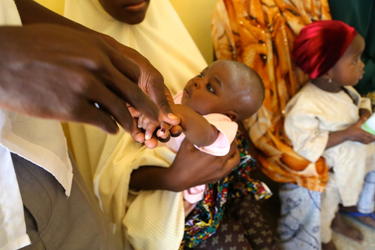 A mark on the finger after a dose of the oral vaccine means another child is covered in Nigeria's fight to eradicate polio. Only one disease has ever been eradicated -- smallpox in 1980. 
