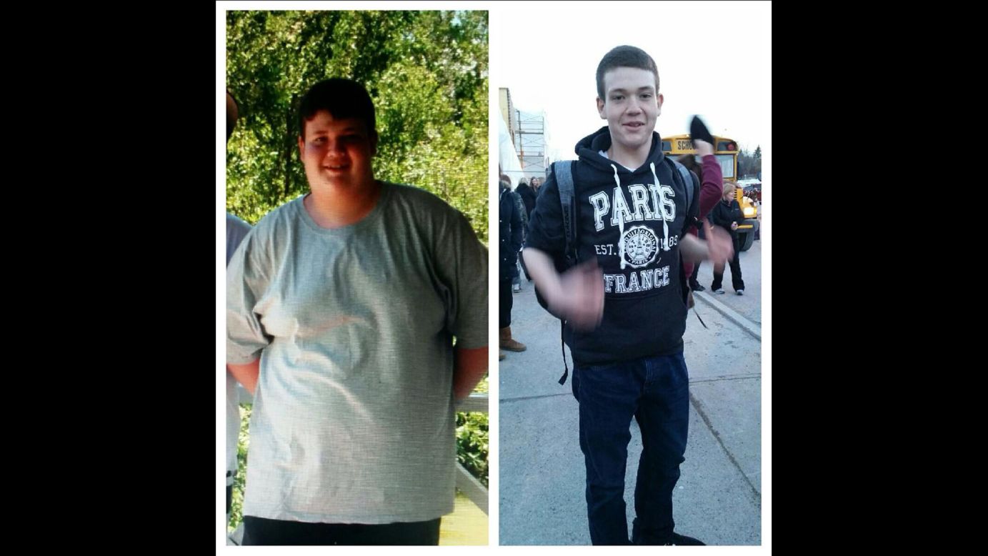 Teenager Adam Park lost 165 pounds in a little over two years.