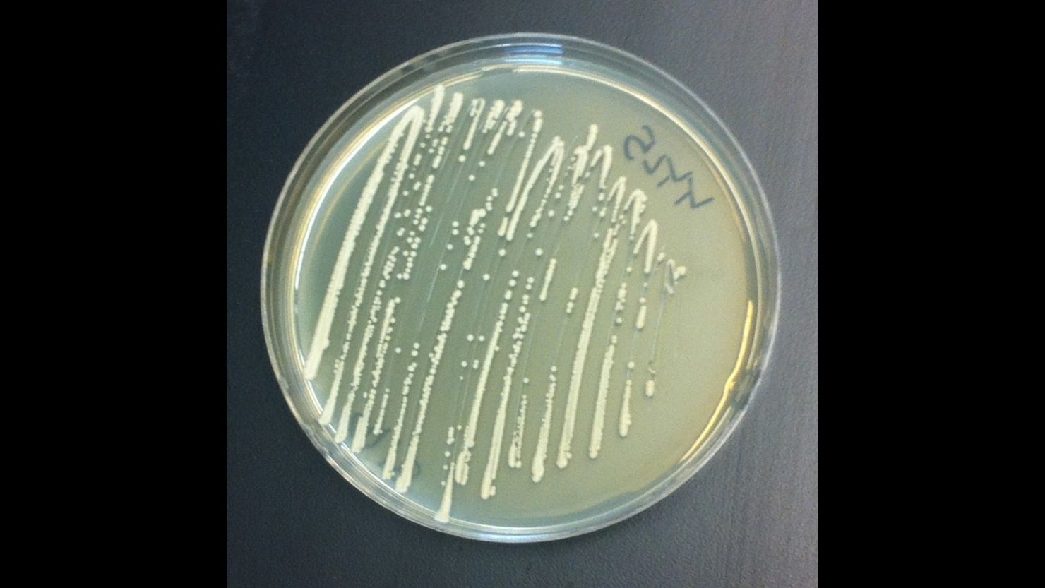 These bioengineered strains of yeast can produce synthetic narcotics. 