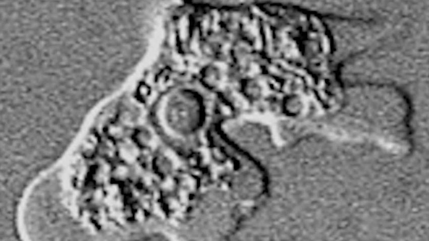 brain eating amoeba cohen explainer orig mg_00011325.jpg