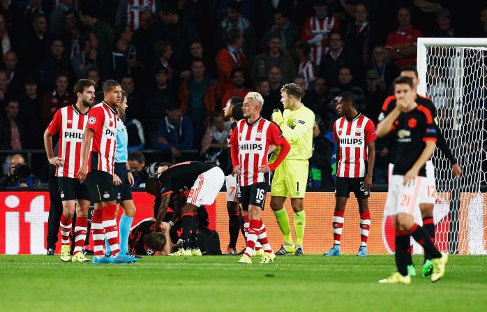 Luke Shaw of Manchester United suffered a serious injury after a hard challenge during the UEFA Champions League Group B match between PSV Eindhoven and Manchester United at PSV Stadion on Tuesday. 