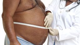 obese man doctor