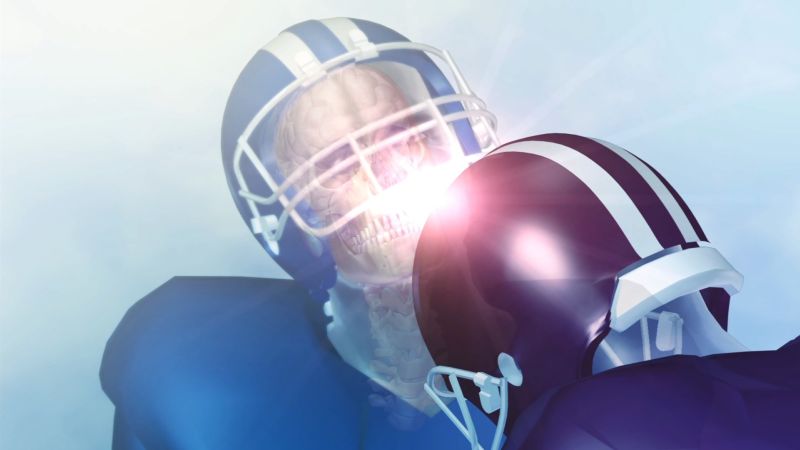 NFL, Under Armour and GE Invest in Concussion-Fighting Technology