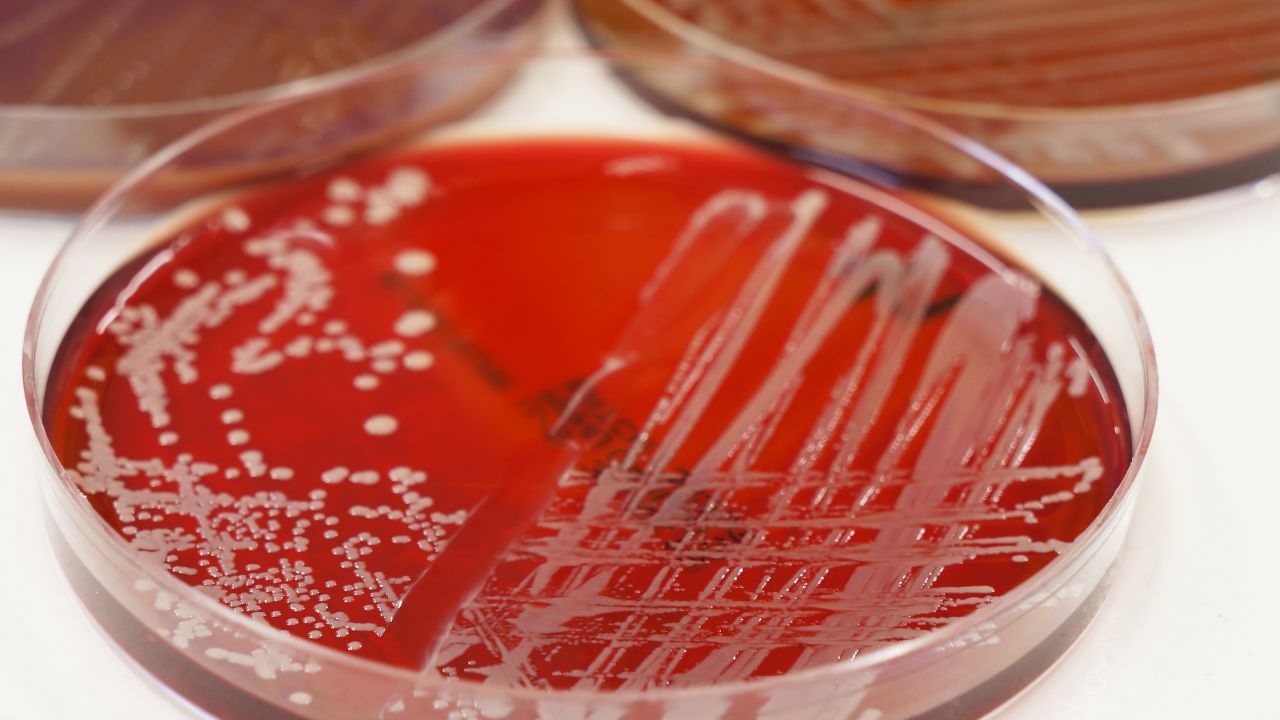 Some bacteria in hospitals are resistant to even the most powerful antibiotics. Seventy-five thousand people die every year from infections that patients catch at hospitals. It may be uncomfortable to ask, but make sure doctors and nurses wash their hands before they touch you, even if they're wearing gloves.