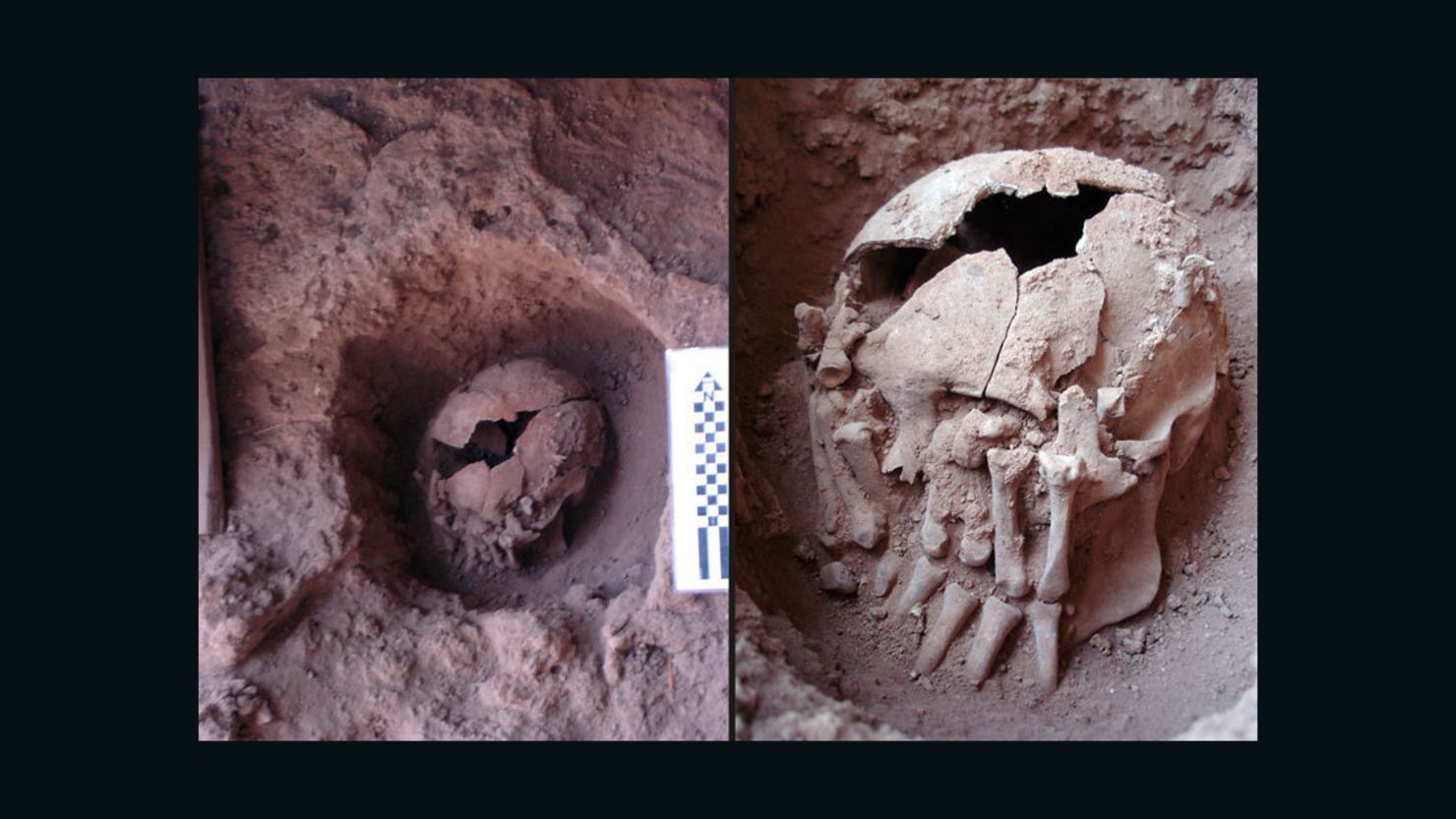 9,000-year-old skull may be oldest known case of ritual decapitation | CNN