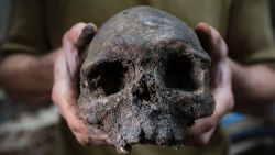 LONDON, ENGLAND - SEPTEMBER 21:  A skull forms part of a collection of bones that were found among the stepped footings of Westminster Abbey's south transept, on September 21, 2015 in London, England. The footings were built from Reigate stone between 1246 and1250, during the reign of Henry III, and back filled with charnel material comprising mostly of femurs and skulls from earlier burials. The square hole on the skull is likely from pick axes used to dig out the bones in the 13th century. The area is currently being excavated as part of the transform of part of the 13th-century Triforium into a new viewing and gallery area that will be open to the public for the first time. As well as exhibiting many historical objects from the abbey, the new £19m GBP space will give visitors views down over the abbey buildings and the neighbouring Palace of Westminster. The work is due to be completed by 2018  (Photo by Dan Kitwood/Getty Images)