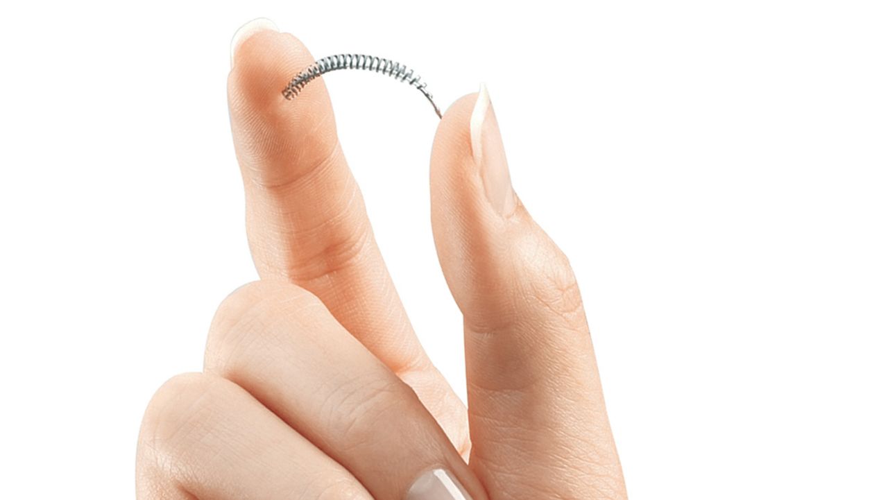 02 fda essure contraceptive