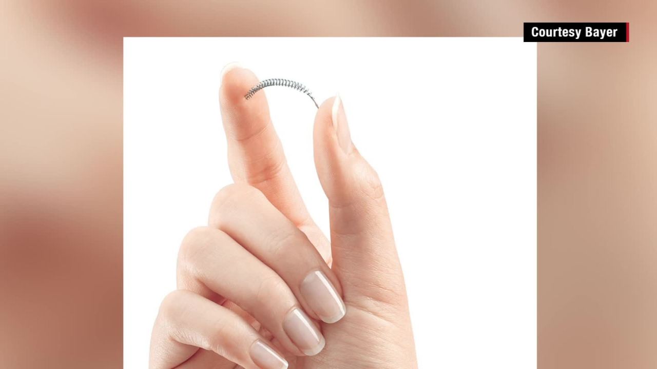 Essure sterilization method under fire_00003911.jpg