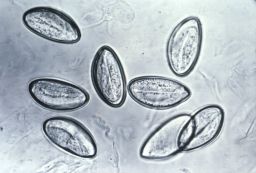 Pinworm infections occur when people swallow the worm eggs. 