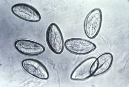 Pinworm infections occur when people swallow the worm eggs.