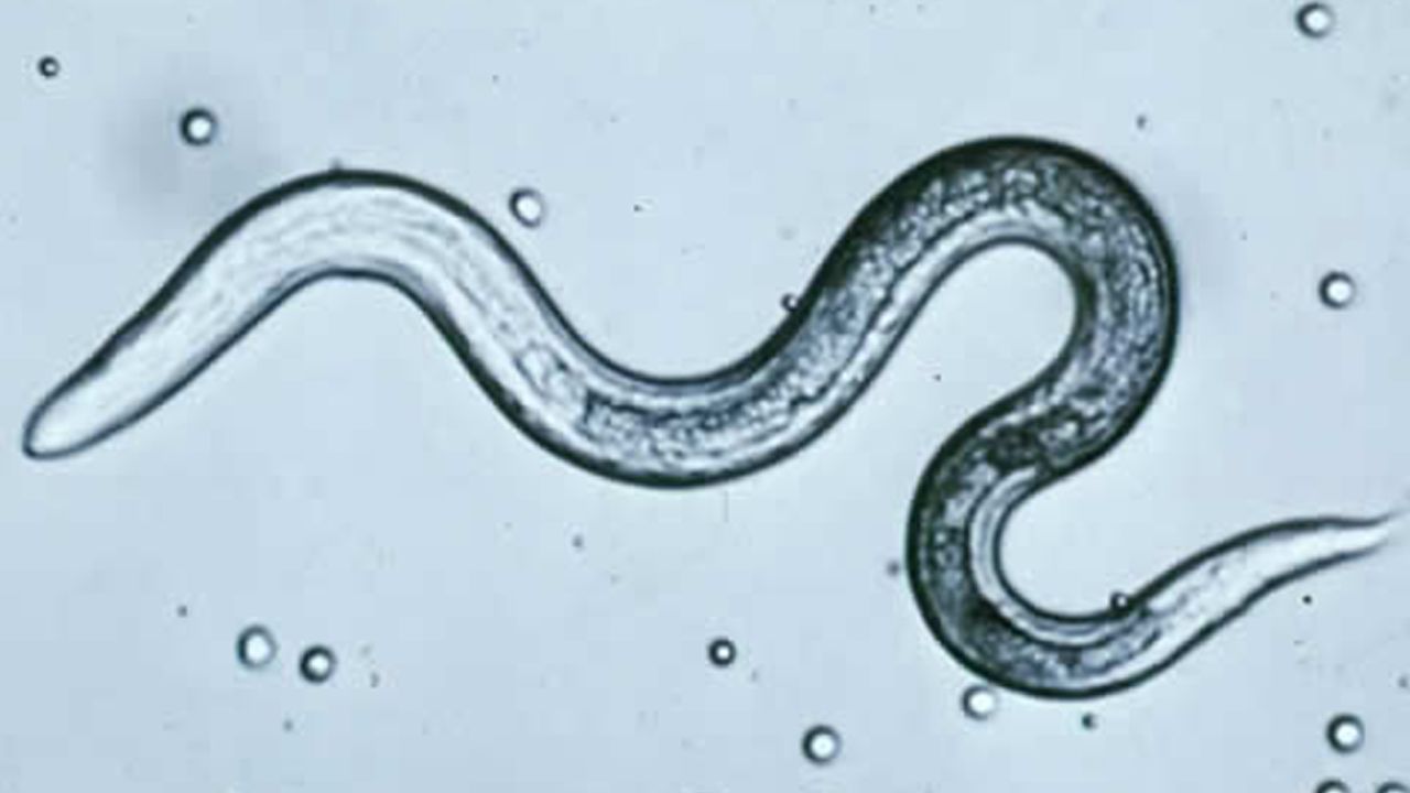 Toxocariasis infections, caused by the toxocara roundworm, can bring about serious health problems.
