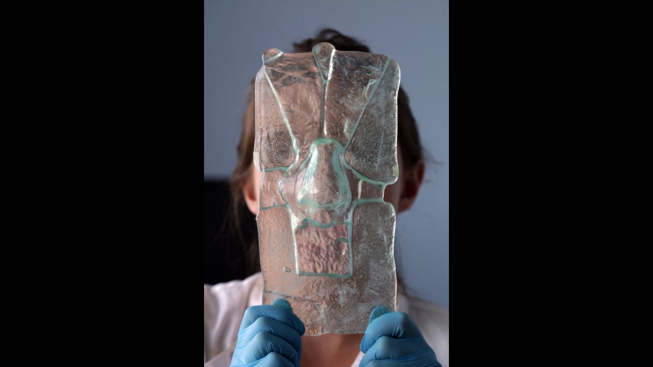 Researcher Claire Crowley holds up a glass mold of a patient's nose, which is used to create a new nose.